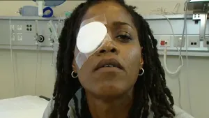 Een tandenborstel in je oog