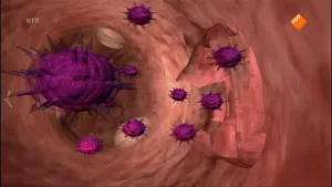 Ebola