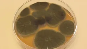 Bacteriën en schimmels in je eten