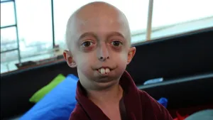 Bjorn, gewoon YOLO