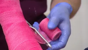 Een ander soort gips voor elke breuk