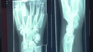 De binnenkant van je lichaam op de foto