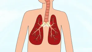 Wat is longontsteking?