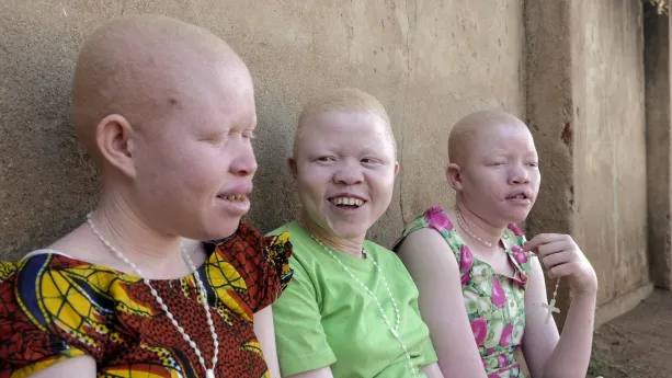 Het meisje met de witte huid