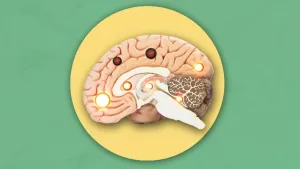 Als je niet begrepen wordt