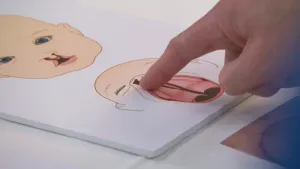 Foto van een plaat waarop een babyhoofd is getekend met open mond met schisis, een vinger wijst ernaar.