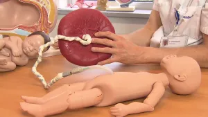 Foto van een model van een baby, pop, met de navelstreng en de placenta eraan.