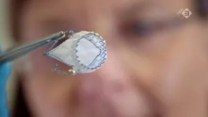 Foto, van dichtbij genomen, close-up, van een kunsthartklep.