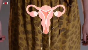 Schematische tekening van de eierstokken van een vrouw.