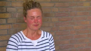 Foto van een vrouw met rood verbrand gezicht, ten gevolge van pepperspray.