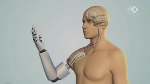 Tekening van een mens met een robotarm, ook de hersenen zijn in het hoofd getekend en de verbindingen met die arm.