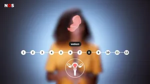 Pro-choice of pro-life