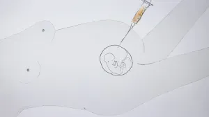 Tekening van doorsnede van de buik van een vrouw in verwachting, je ziet het jonge baby'tje, met injectiespuit met naald in de buik gestoken.