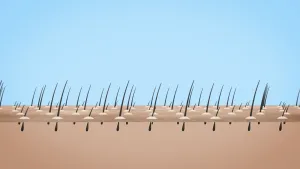 Schematische tekening van de huid in doorsnede van iemand die kippenvel heeft, je ziet de haartjes en verdikkingen rondom de onderkant ervan.