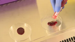 Een foto van twee ronde, plastic bakjes op een witte tafel. Links zit er rood menselijk bloed in. Rechts wordt er menselijk bloed, dat slangengif bevat en er klonterig uitziet, aan toegevoegd uit een plastic buisje door een blauw gehandschoende hand. 