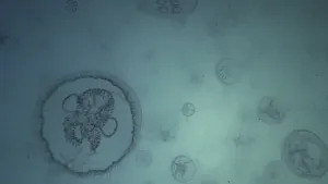 Een foto van kwallen in water van onderop genomen. De ronde vormen van kleine kwallen en één grote kwal zijn te zien. In het midden zitten vier ronde cirkels tegen elkaar aan, aan de zijkant van de grote kwal lijken er kleine haartjes uit te steken.