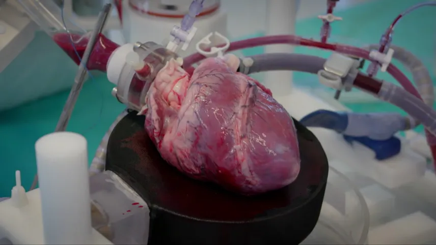 Een foto van een menselijk hart dat op een ronde, zwarte schijf ligt. Het hart is rood en roze van kleur met paarsachtige lijntjes erop. Het hart zit bovenaan vast aan een ronde plastic klem, waaruit vier slangetjes lopen, drie met rode vloeistof erin.