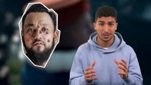 Een foto van Nizar met ernaast een uitgeknipte foto van het gezicht van een man met een zwarte snor, baard en haar. De man heeft zeven donkerpaarse vlekken in zijn gezicht en ziet eruit zoals mensen met de ziekte de pest er in de 14e eeuw uitzagen.