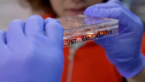 Een foto van twee handen in handschoenen van blauw plastic die een plastic doosje vasthebben. Het plastic doosje is van de zijkant zichtbaar en er zitten vakjes met doorzichtige vloeistof in. De vloeistof bevat stamcellen uit menselijk bloed. 