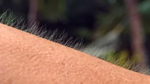 Een foto van een menselijke huid van heel dichtbij, waarop de haartjes omhoogstaan. Dit heet kippenvel. Bij kippenvel gaan als een deel van het lichaam het koud heeft, de haartjes op de huid overeind staan, vooral op onderarmen, benen, nek of rug.