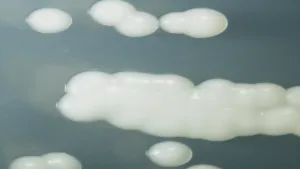 Een foto van witte smurrie op een gladde ondergrond. De foto is van heel dichtbij genomen. Je ziet ook witte druppels. 