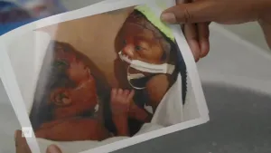 Een foto van twee handen die een foto vasthouden. Op die foto zie je twee pasgeboren baby's. Het is een tweeling. Een van de baby's heeft een slangetje in zijn neus. De andere baby houdt zijn hand vast.