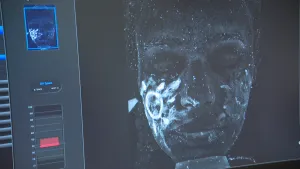 Een foto van een beeldscherm met een computerprogramma om menselijke huid dat door zonlicht verbrand is te kunnen zien. Op het scherm staan de tekst "UV Spots",  een beoordeling van 10 tot 100 en een donker gezicht van een mens met lichtblauwe plekjes.