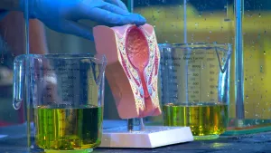 Een foto van een beeld van de menselijke blaas dat op een tafel staat tussen twee maatbekers in. De maatbekers zijn voor minder dan de helft gevuld met urine. 