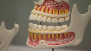 Een foto van een model van een menselijk gebit met tanden en in de kaak zichtbare wortels van de tanden in rood gekleurd tandvlees.