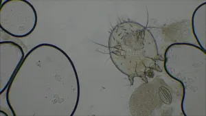 Beeld van microscopisch onderzoek van een mijt, rond beestje met kleine pootjes, in een mensenlijf.